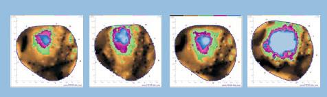 PiCUS-3彈性波樹(shù)木斷層畫(huà)像診斷儀 PiCUS-3彈性波樹(shù)木斷層畫(huà)像診斷儀