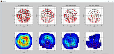 TRU樹木雷達檢測系統(tǒng)為古樹名木保護保駕護航